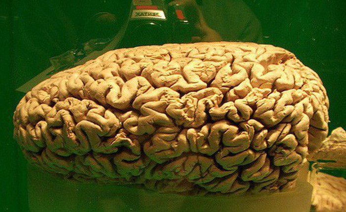 6 quan niệm sai lầm về bộ não có thể bạn không biết