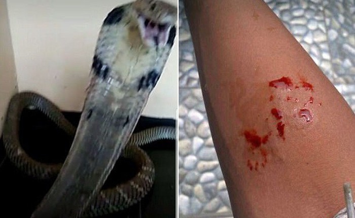 Bị rắn hổ mang cắn nhưng vẫn up ảnh lên MXH, cậu bé 14 tuổi chết thảm