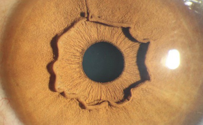 Đây là con mắt của một người, nhưng vì sao lại kỳ dị thế này?