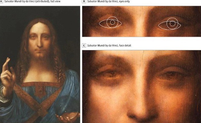 Leonardo da Vinci trở thành danh họa vĩ đại vì mang tật lác mắt hiếm gặp?