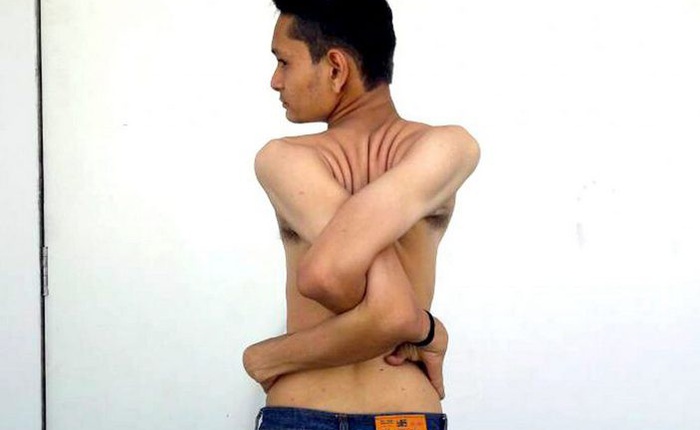 Gặp gỡ chàng trai Ấn Độ có cơ thể uốn dẻo như cao su, uốn vai 360 độ và xoay cổ 180 độ