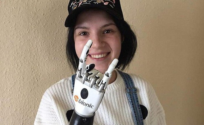 Câu chuyện cô gái trẻ với cánh tay robot và nỗi đau đằng sau khiến ai nghe được cũng phải rùng mình khiếp sợ