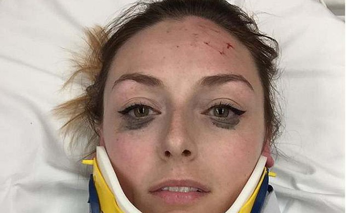 Review bút kẻ mắt bằng cách selfie dù đang nằm viện, cô gái được Internet tán thưởng