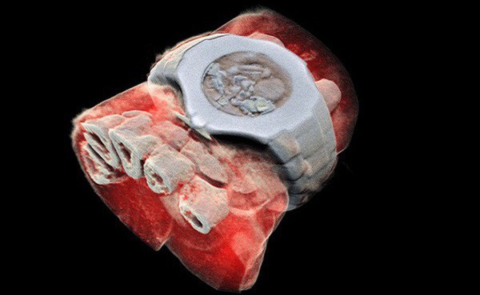 Đây là hình ảnh X-quang màu 3D đầu tiên trên thế giới, đừng xem nếu bạn yếu tim