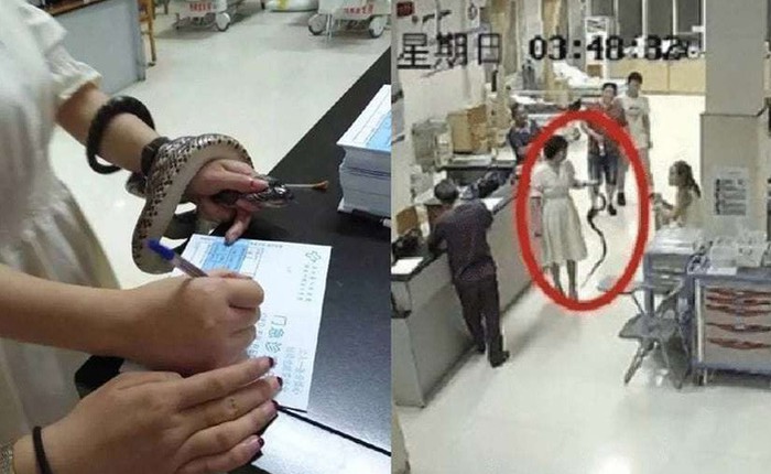 Trung Quốc: Bị cắn nhưng không biết là rắn gì, cô gái bình tĩnh túm cổ nó mang đến bệnh viện