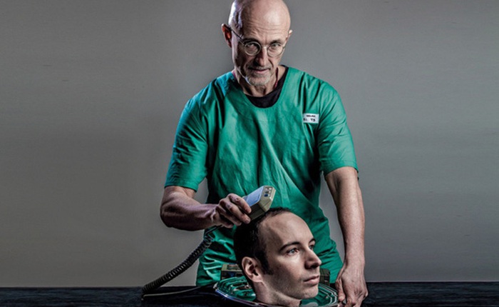 Một ca phẫu thuật ghép đầu người sẽ được thực hiện trước năm 2030?