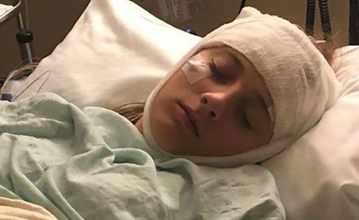 Sau tai nạn giao thông, cô bé 16 tuổi mắc bệnh mất trí nhớ kỳ lạ: cứ mỗi 2 tiếng lại mất sạch ký ức trước đó