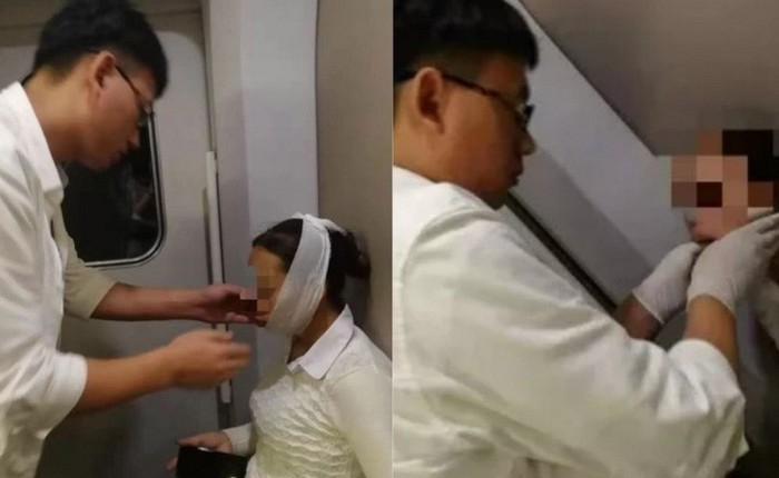 Trường hợp hi hữu: Một người phụ nữ Trung Quốc bị “liệt khẩu hình” vì cười quá lớn