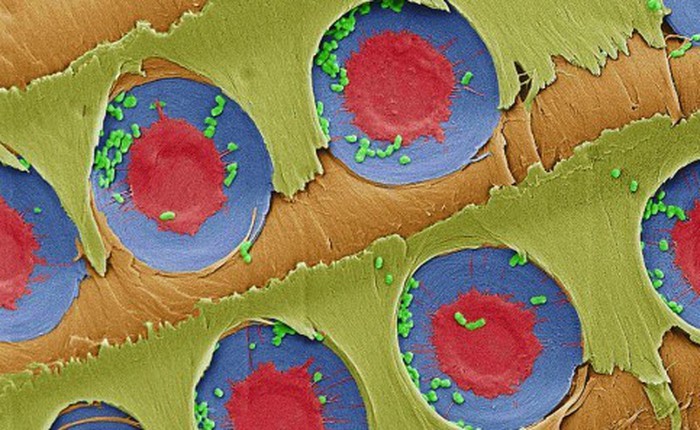 Các nhà khoa học phát hiện khả năng lọc vi khuẩn của gỗ thông