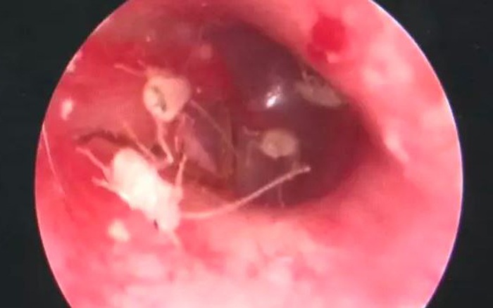 Gián Bò Lên Người Số Mấy - Ý Nghĩa, Phong Thủy Và Cách Xử Lý